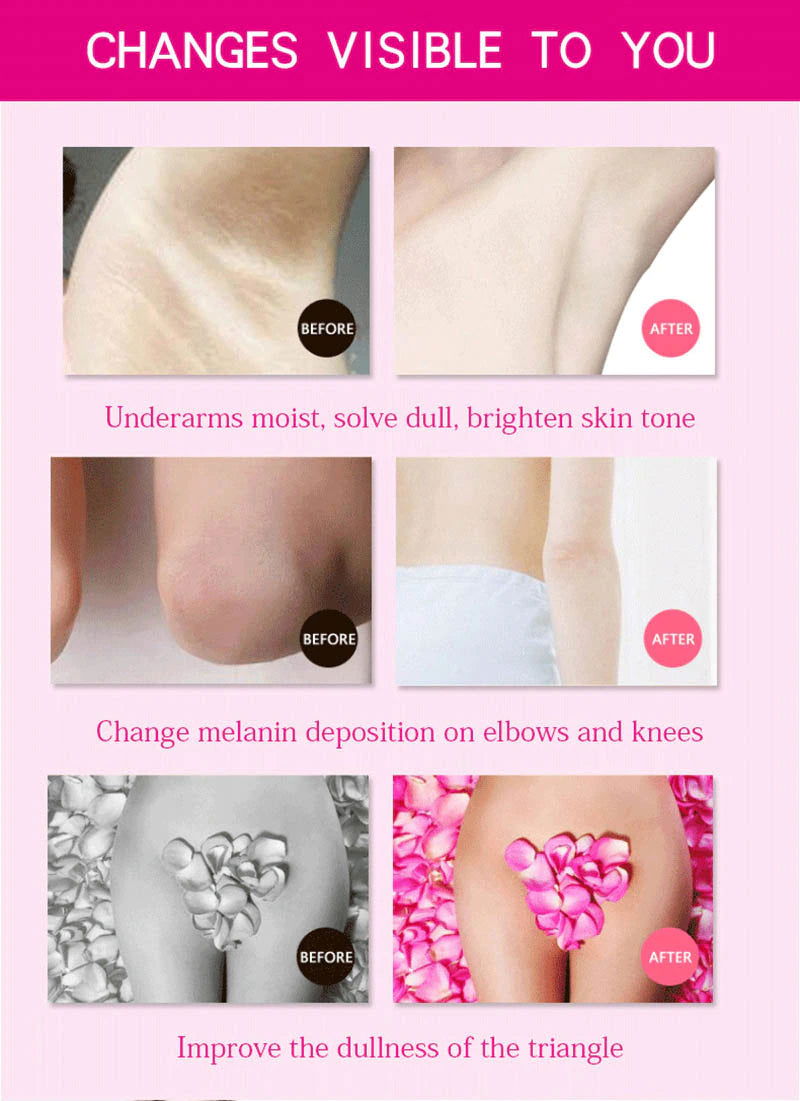 3Days Armpit Whitening Cream Skin Lightening Bleaching Cream - China To BD Web