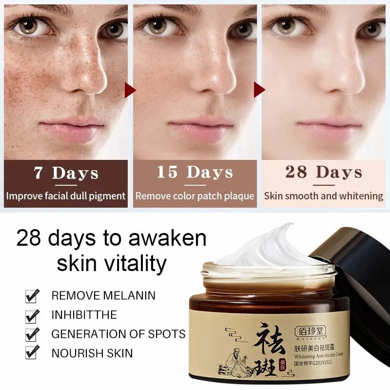 BAIZTON Whitening Anti Freckle Cream (Facial) - China To BD Web