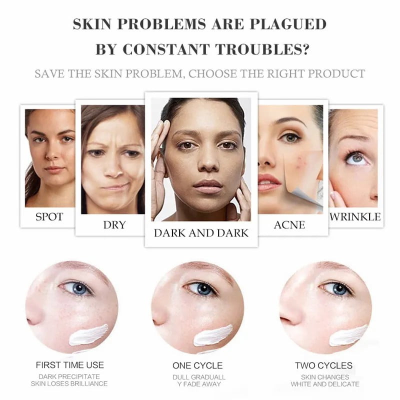 BAIZTON Whitening Anti Freckle Cream (Facial) - China To BD Web