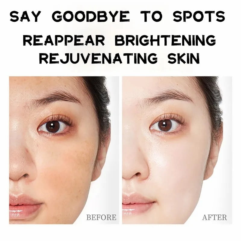 BAIZTON Whitening Anti Freckle Cream (Facial) - China To BD Web