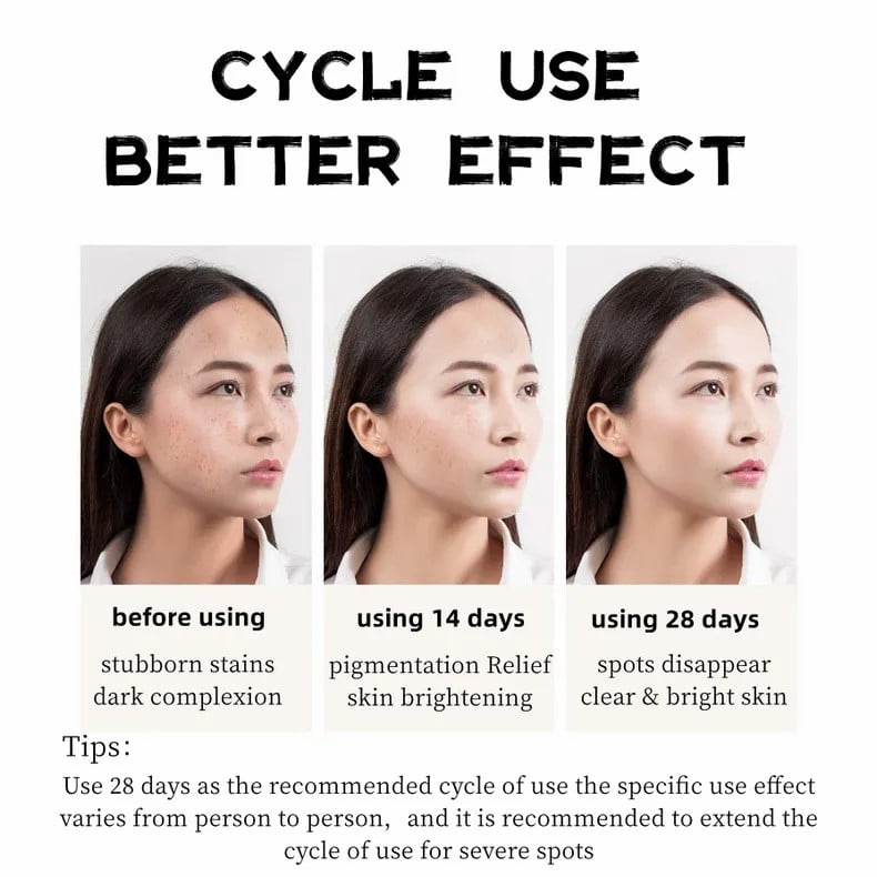 BAIZTON Whitening Anti Freckle Cream (Facial) - China To BD Web