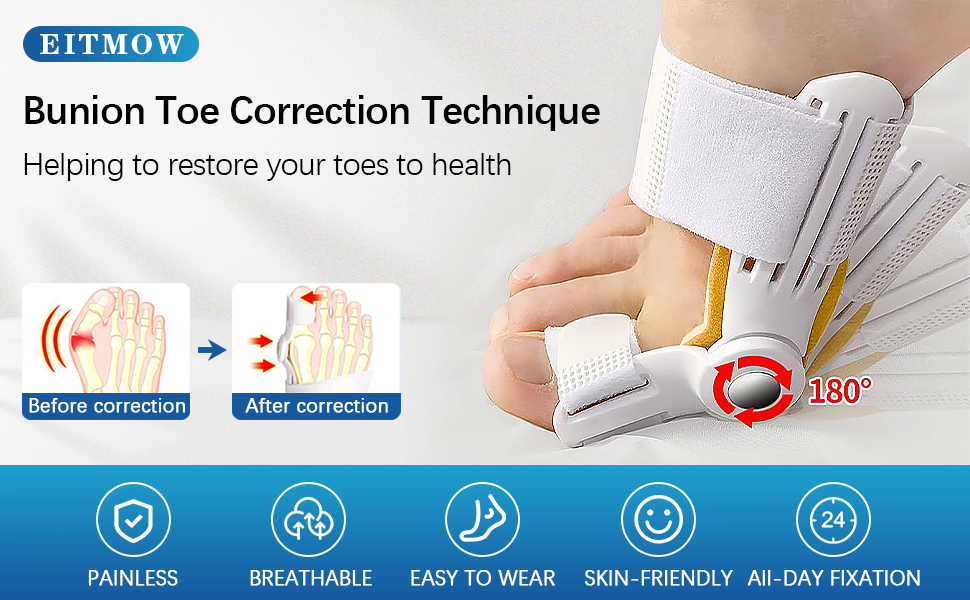 Orthopedic Bunion Corrector Device Hallux Valgus Toe Correction Pedicure Foot Care Tool Thumb Big Bone Orthotics - China To BD Web