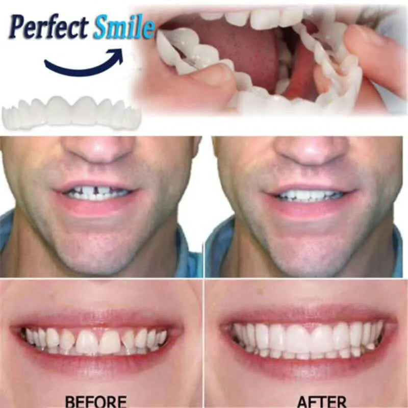 Adult Adjustable Dentures Teeth Set-1 pair