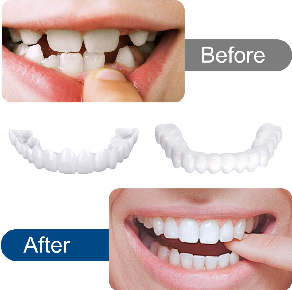 Clip in Veneers Teeth,Fake Braces-5 pair