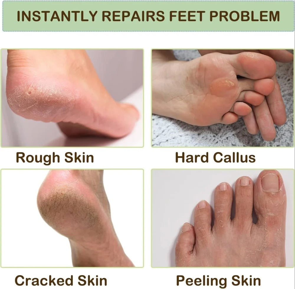 Silicone Pedicure Moisturizing Socks-1 Pair